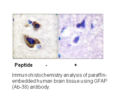 GFAP (Ab-38) Antibody - image 2