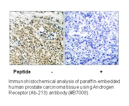 Androgen Receptor (Ab-213) Antibody - image 1