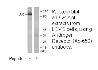 Androgen Receptor (Ab-650) Antibody - image 1