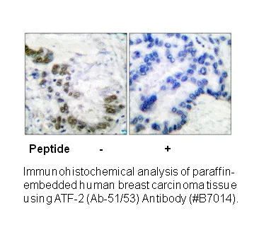 ATF2 (Ab-69 or 51) Antibody - image 1