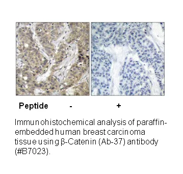 Catenin-β (Ab-37) Antibody - image 2