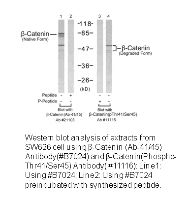 Catenin-β (Ab-41/45) Antibody - image 1