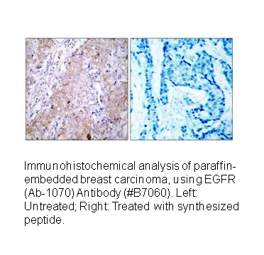 EGFR (Ab-1070) Antibody - image 1