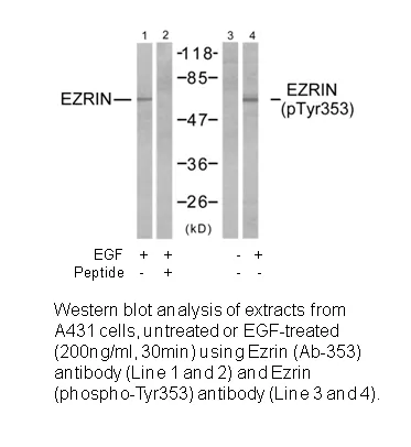Ezrin (Ab-353) Antibody - image 1
