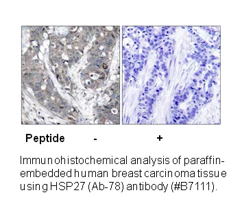 HSP27 (Ab-78) Antibody - image 1