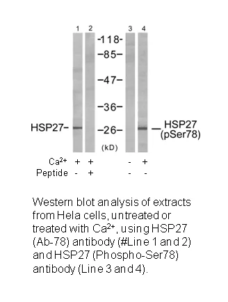 HSP27 (Ab-78) Antibody - image 2
