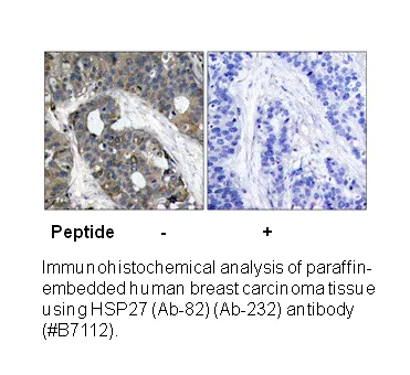 HSP27 (Ab-82) Antibody - image 1