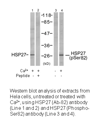 HSP27 (Ab-82) Antibody - image 2