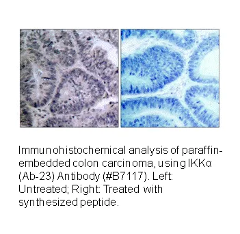 IKK-α (Ab-23) Antibody - image 2