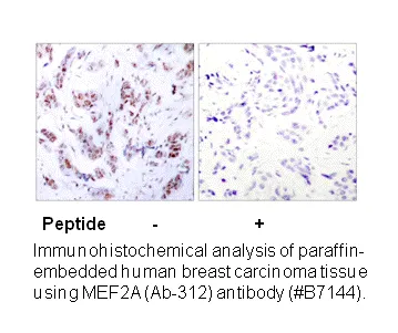 MEF2A (Ab-312) Antibody - image 2