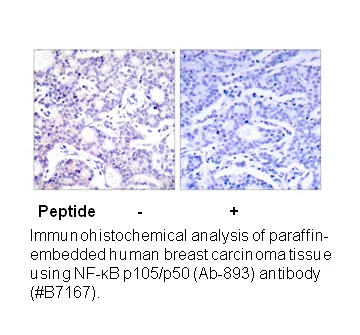 NF-κB p105/p50 (Ab-893) Antibody - image 2