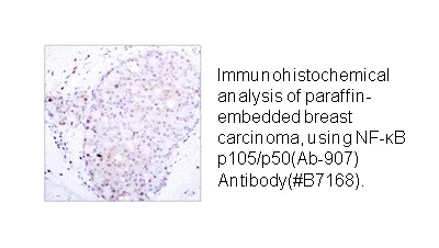 NF-κB p105/p50 (Ab-907) Antibody - image 1