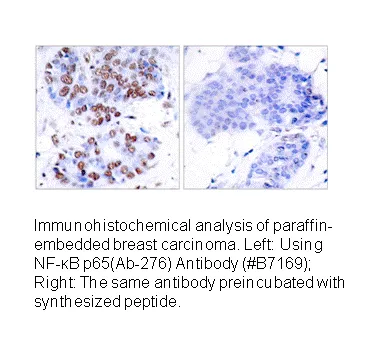 NF-κB p65 (Ab-276) Antibody - image 1