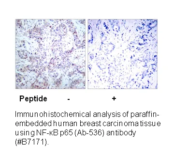 NF-κB p65 (Ab-536) Antibody - image 1