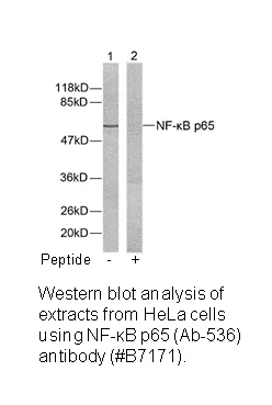 NF-κB p65 (Ab-536) Antibody - image 2