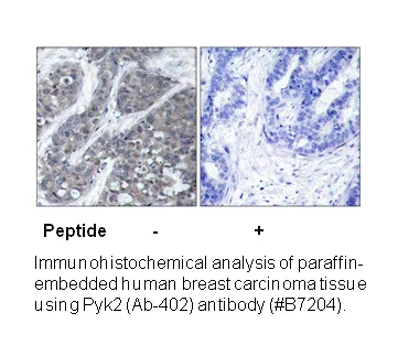 PYK2 (Ab-402) Antibody - image 1