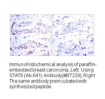 STAT6 (Ab-641) Antibody - image 2