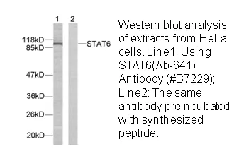 STAT6 (Ab-641) Antibody - image 1