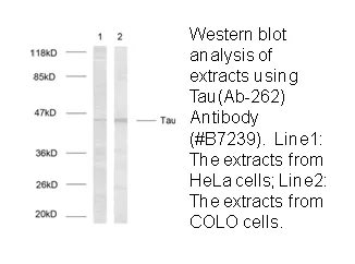 Tau (Ab-262) Antibody - image 1