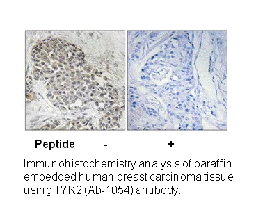TYK2 (Ab-1054) Antibody - image 2