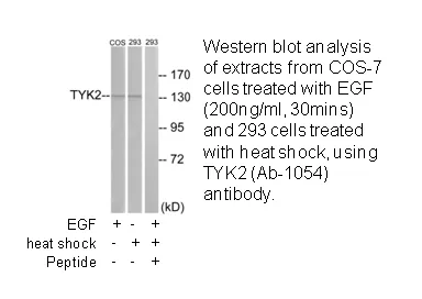 TYK2 (Ab-1054) Antibody - image 3