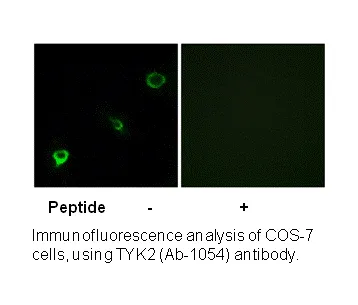 TYK2 (Ab-1054) Antibody - image 1