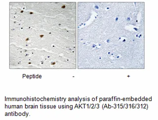 AKT1/2/3 (Ab-315/316/312) Antibody - image 1