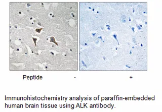 ALK (Ab-1096) Antibody - image 1
