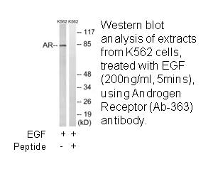 Androgen Receptor (Ab-363) Antibody - image 1