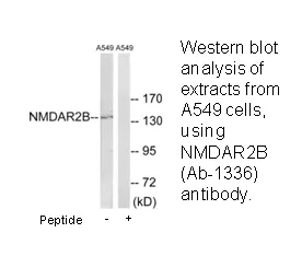 NMDAR2B (Ab-1336) Antibody - image 1