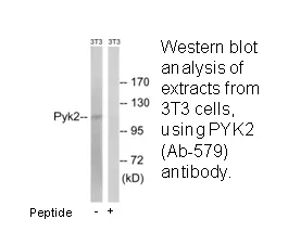 PYK2 (Ab-579) Antibody - image 1