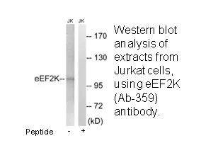 EEF2K (Ab-359) Antibody - image 1
