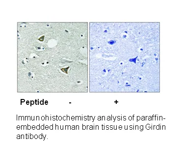 Girdin (Ab-1417) Antibody - image 1