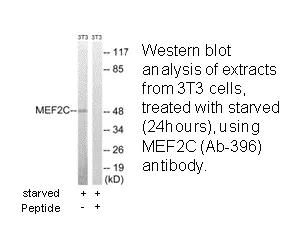 MEF2C (Ab-396) Antibody - image 1