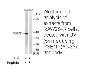 PSEN1 (Ab-357) Antibody - image 1