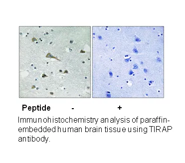 TIRAP (Ab-86) Antibody - image 1