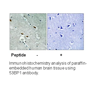 53BP1 (Ab-1778) Antibody - image 1