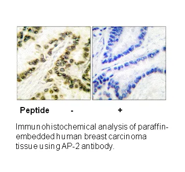 AP-2 Antibody - image 1