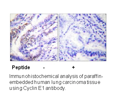 Cyclin E1 Antibody - image 2
