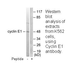Cyclin E1 Antibody - image 1