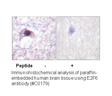 E2F6 Antibody - image 1