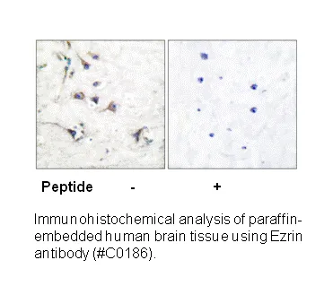 Ezrin Antibody - image 1