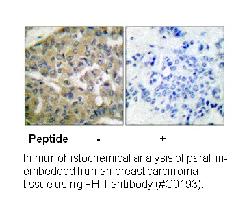 FHIT Antibody - image 2