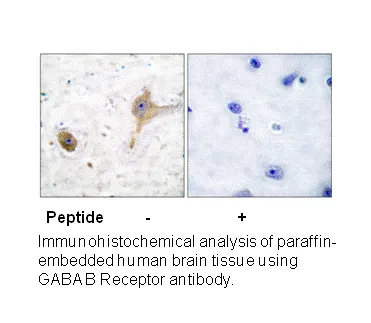 GABA-B Receptor Antibody - image 1