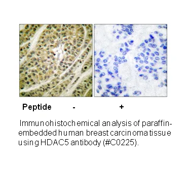HDAC5 Antibody - image 2