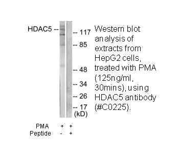 HDAC5 Antibody - image 3