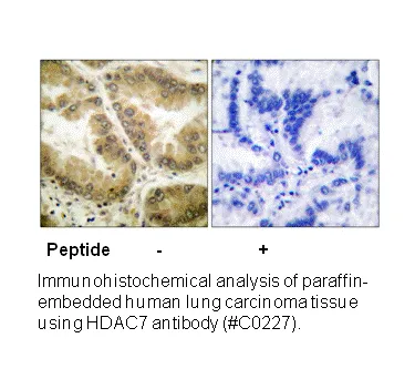 HDAC7 Antibody - image 2