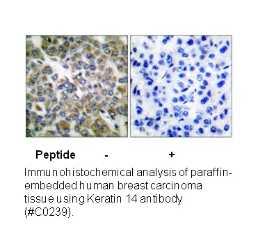 Keratin 14 Antibody - image 3