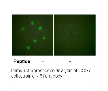 Ki67 Antibody - image 2