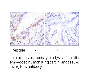 Ki67 Antibody - image 1